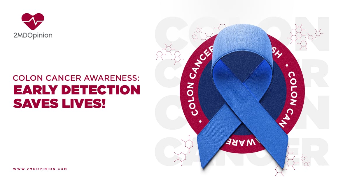 Colon Cancer