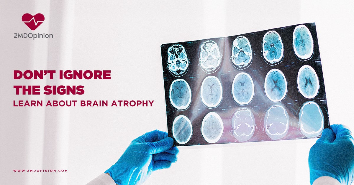 Causes of Brain Atrophy