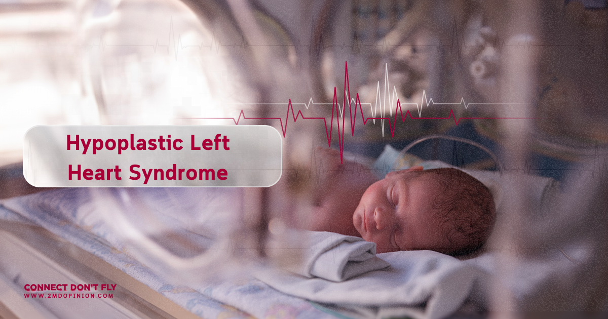 Hypoplastic Left Heart Syndrome