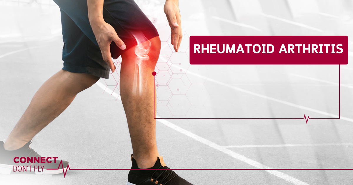 Rheumatoid arthritis